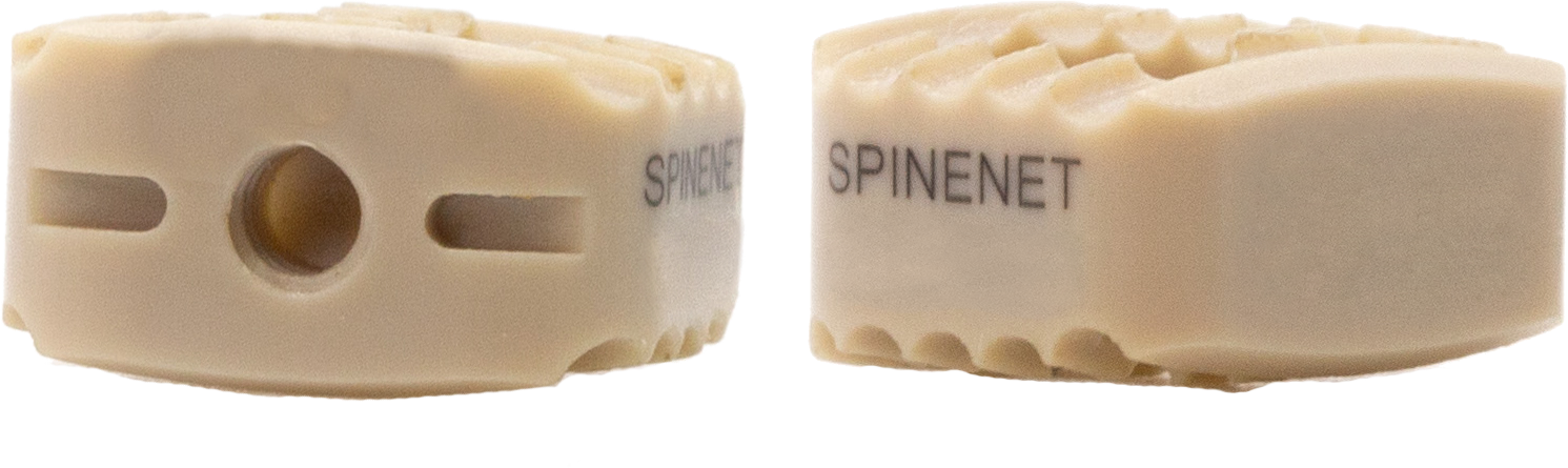 Anterior Cervical Cage